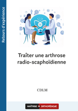 Charger l'image dans la galerie, Traiter une arthrose radio-scaphoïdienne