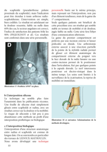 Charger l'image dans la galerie, Traiter une arthrose radio-scaphoïdienne