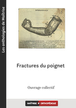 Charger l'image dans la galerie, Fractures du poignet