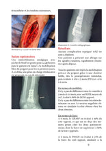 Charger l'image dans la galerie, Fractures du poignet