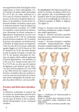 Charger l'image dans la galerie, Fractures du plateau tibial