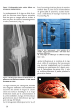 Charger l'image dans la galerie, L'infection ostéo-articulaire T2 : 2018-2022