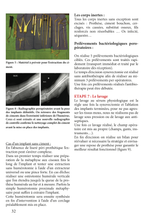 Charger l'image dans la galerie, L'infection ostéo-articulaire T2 : 2018-2022