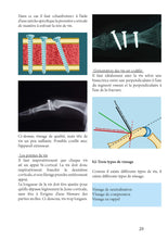 Charger l'image dans la galerie, Ostéosynthèses de la main