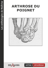 Charger l'image dans la galerie, Arthrose du poignet