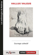 Charger l'image dans la galerie, Hallux valgus