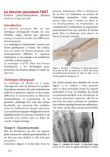 Charger l'image dans la galerie, Hallux valgus