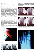 Charger l'image dans la galerie, Hallux valgus