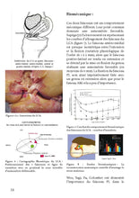 Charger l'image dans la galerie, Le ligament croisé antérieur T1