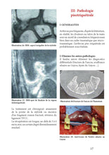 Charger l'image dans la galerie, Les pathologies internes du poignet