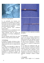 Charger l'image dans la galerie, Fracture et pseudarthrose du scaphoïde