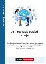 Charger l&#39;image dans la galerie, Arthroscopic guided Latarjet
