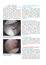 Charger l&#39;image dans la galerie, Diagnosis and Therapeutic options for posterior shoulder dislocation
