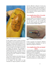 Charger l&#39;image dans la galerie, Focus sur la ligamentoplastie  anatomique arthroscopique - gags et cas cliniques
