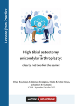 Charger l&#39;image dans la galerie, High tibial osteotomy vs. unicondylar arthroplasty - clearly not two for the same!
