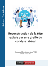 Charger l&#39;image dans la galerie, Reconstruction de la tête radiale par une greffe du condyle latéral
