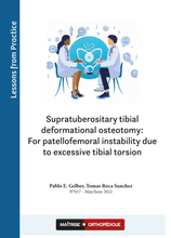 Charger l&#39;image dans la galerie, Supratuberositary tibial deformational osteotomy
