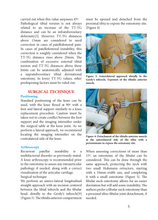 Charger l&#39;image dans la galerie, Supratuberositary tibial deformational osteotomy
