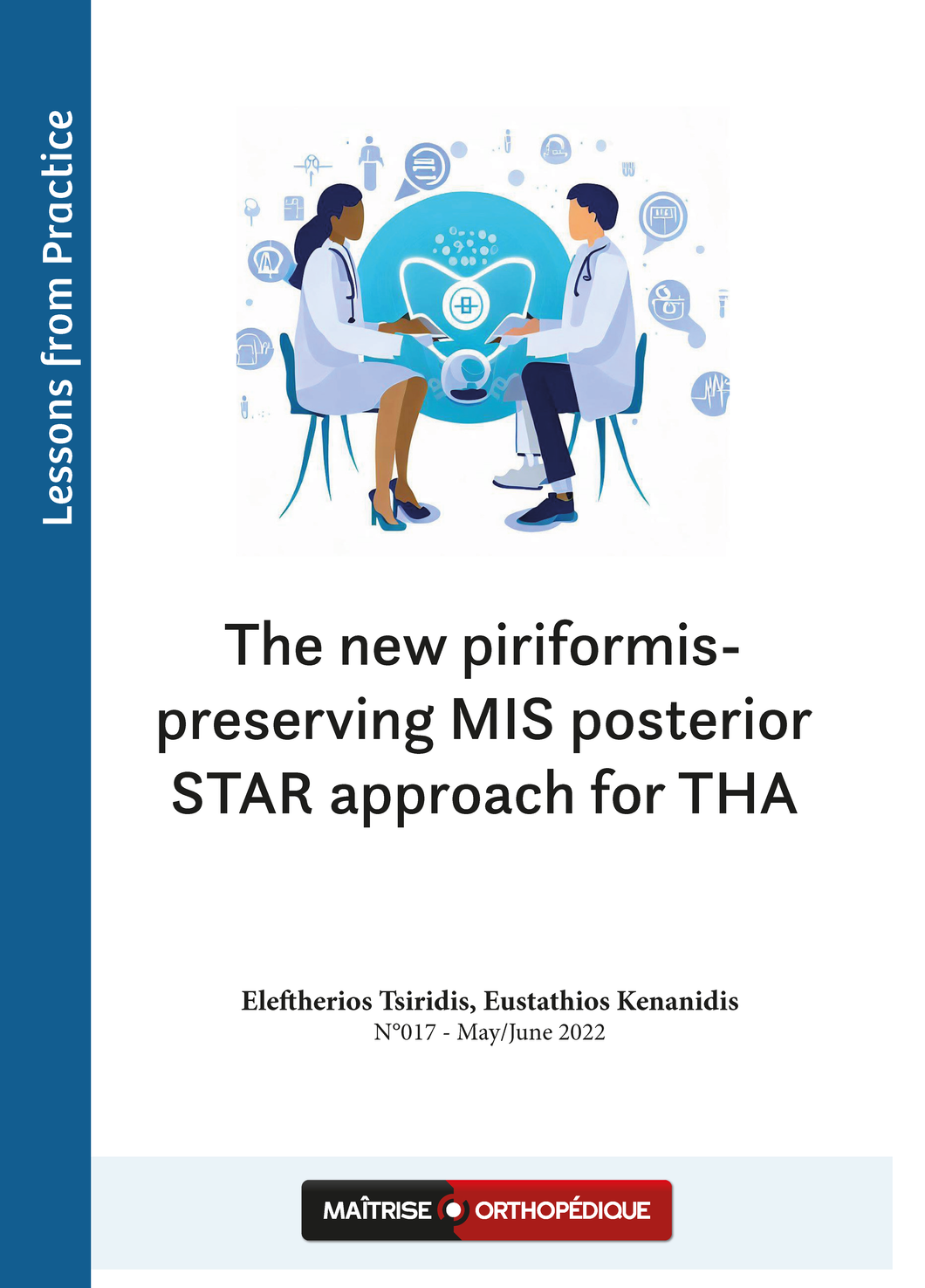 The new piriformis-preserving MIS posterior STAR approach for THA