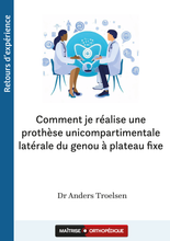 Charger l&#39;image dans la galerie, Comment je réalise une prothèse unicompartimentale latérale du genou à plateau fixe
