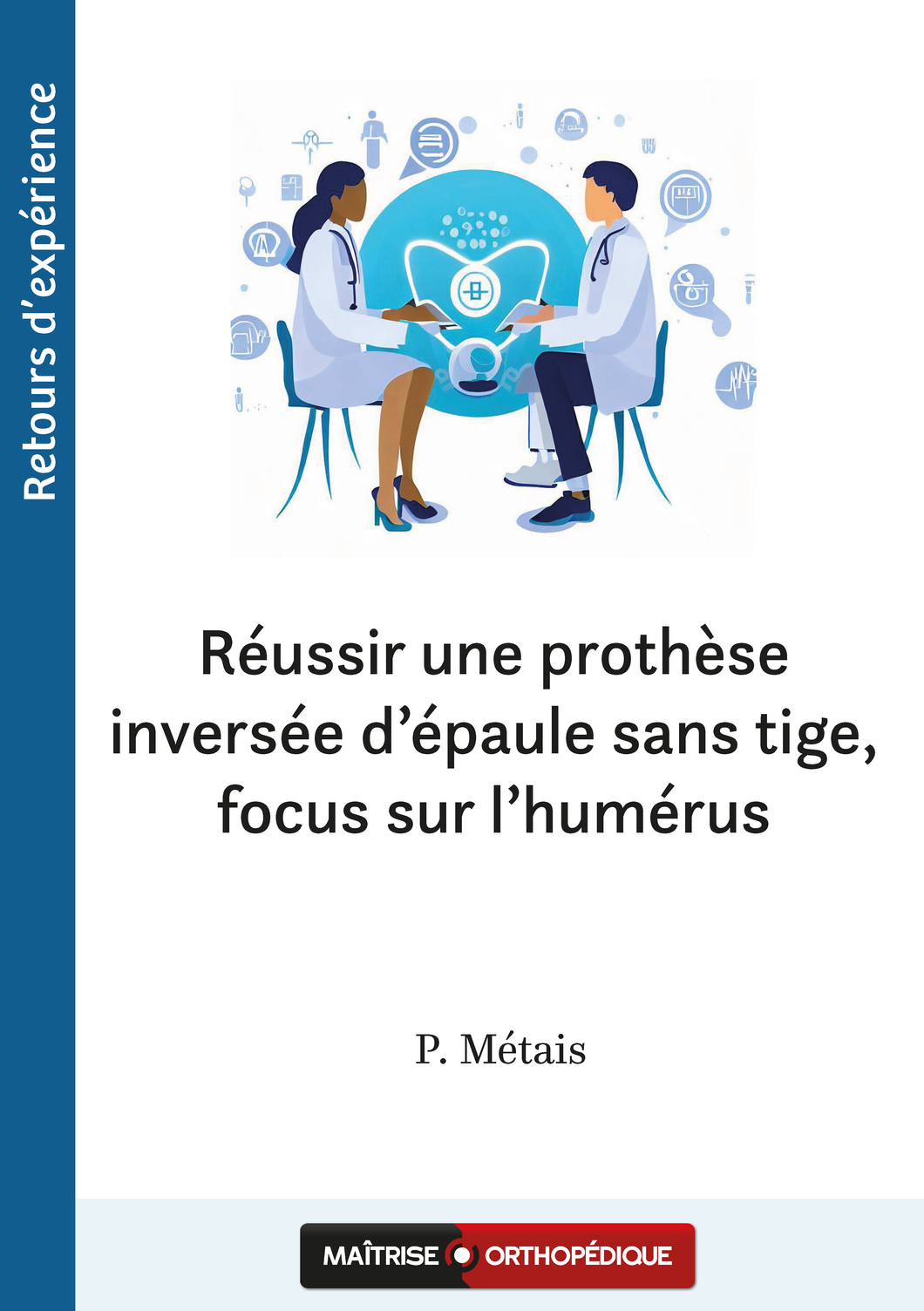 Réussir une prothèse inversée d’épaule sans tige, focus sur l’humérus