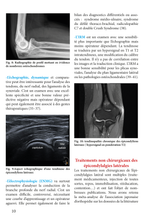 Charger l&#39;image dans la galerie, Tendinopathies du coude
