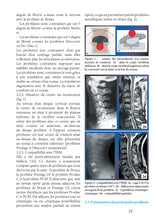 Charger l&#39;image dans la galerie, Pathologies du rachis 2011-2014
