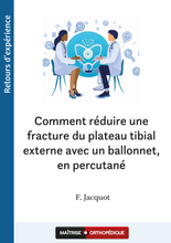 Charger l&#39;image dans la galerie, Comment réduire une fracture du plateau tibial externe avec un ballonnet, en percutané
