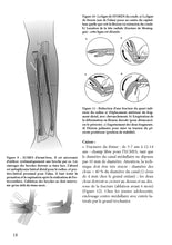 Charger l&#39;image dans la galerie, Orthopédie-traumatologie pédiatrique 2010-2014
