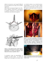 Charger l&#39;image dans la galerie, Pathologies du rachis 2015-2021
