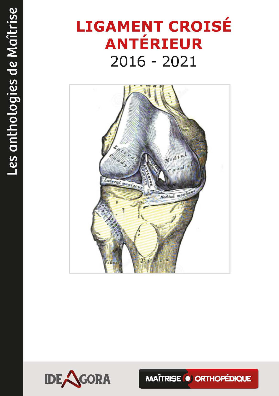 Le ligament croisé antérieur T2