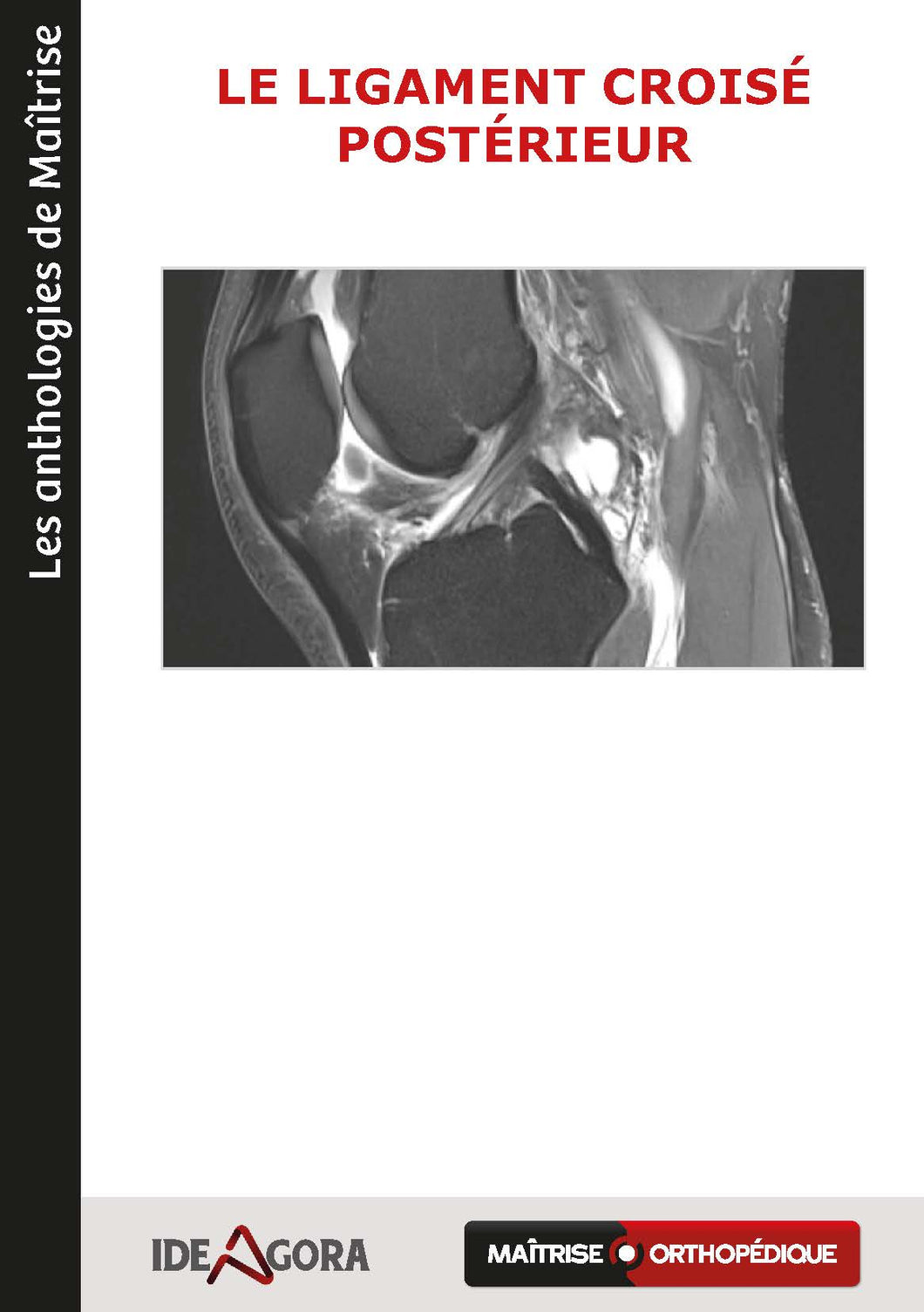 Le ligament croisé postérieur