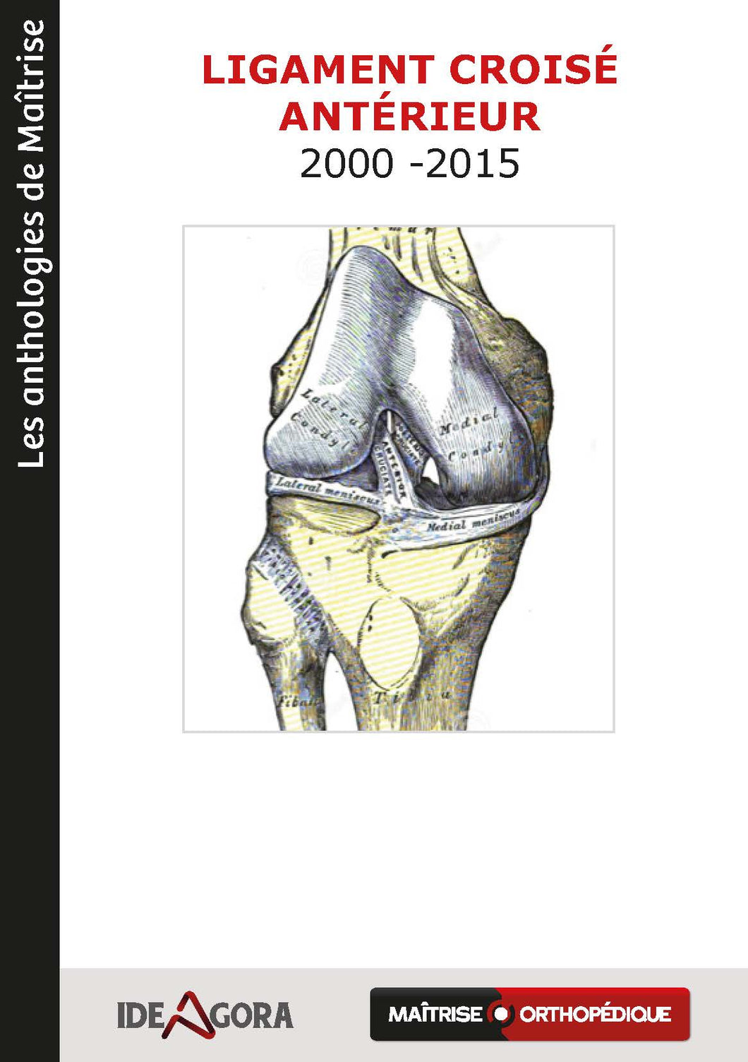 Le ligament croisé antérieur T1