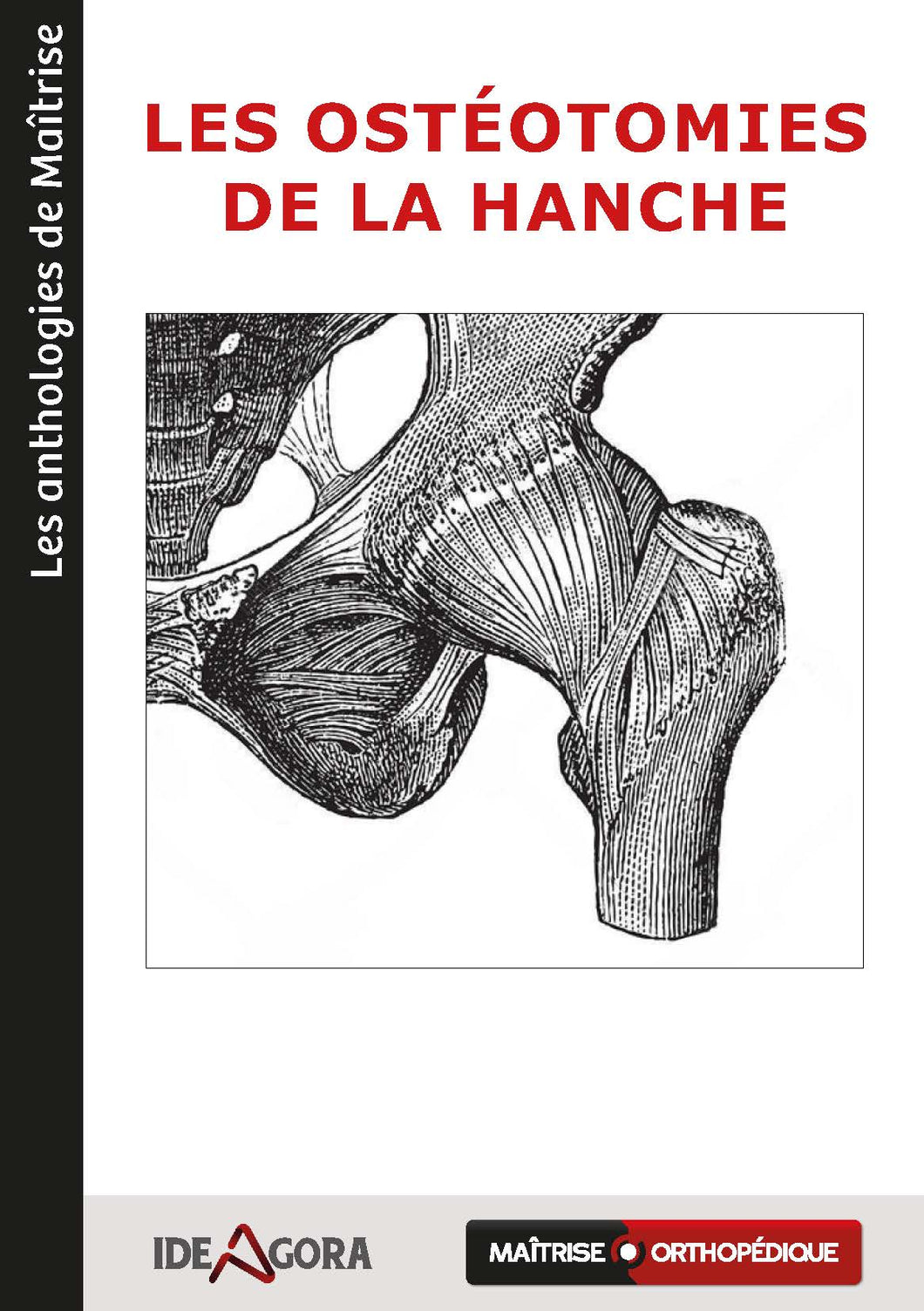 Les ostéotomies de la hanche